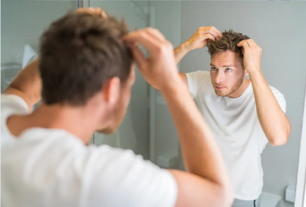 The Most Effective Hair Regrowth Solution for Men: A 6-Month Kirkland Minoxidil Experience