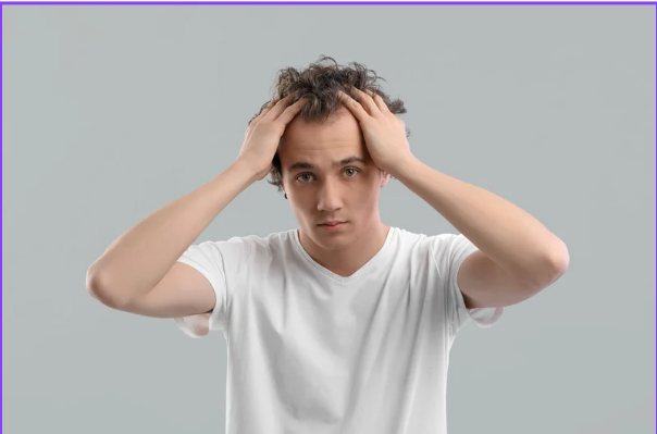 Stop Hair Loss: A Complete Guide to Using Kirkland Minoxidil 5%