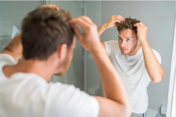 6-Month Solution to Hair Loss: How Kirkland Minoxidil 5% Can Help