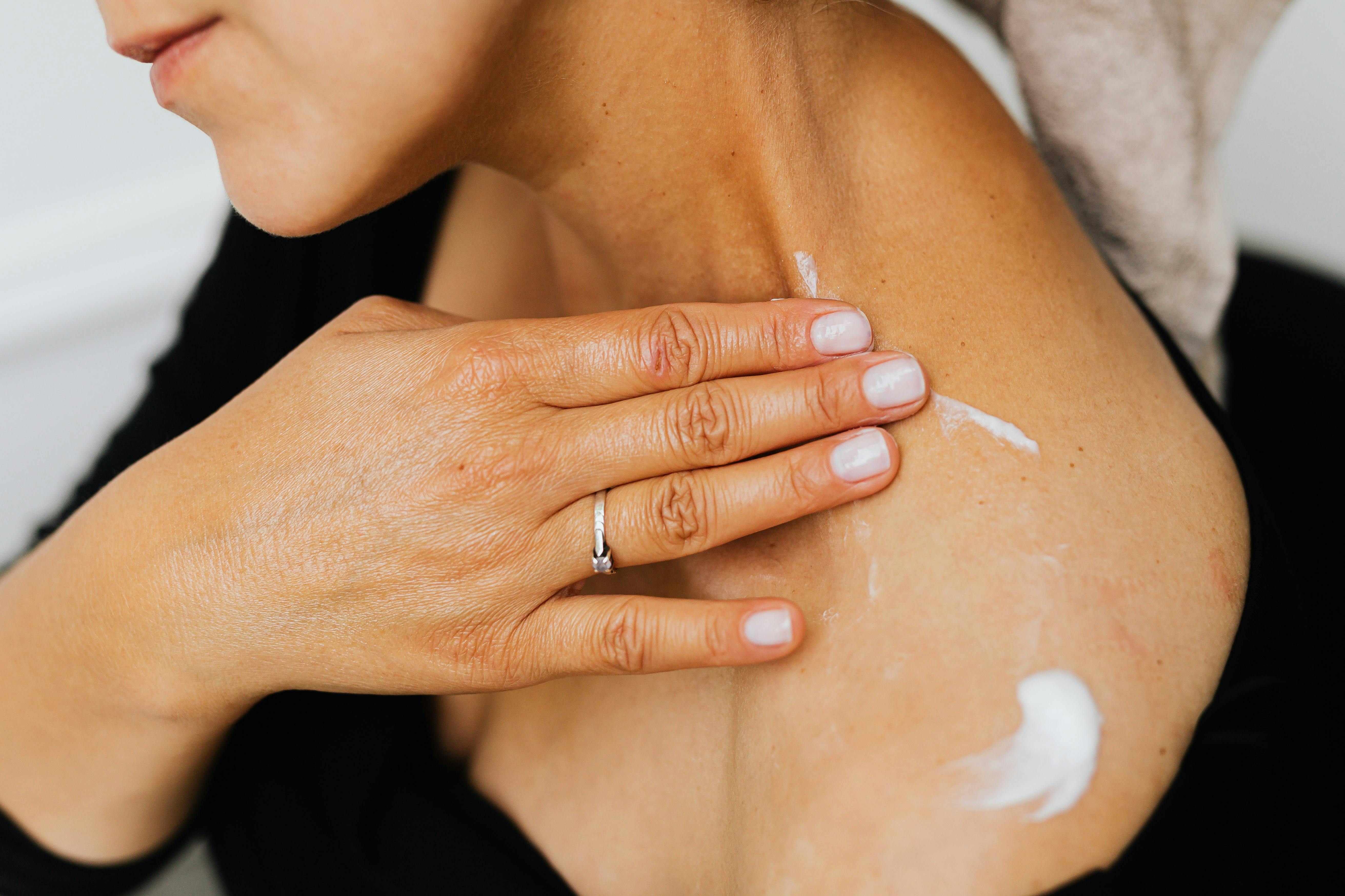 Understanding Hydrocortisone Cream and Its Benefits for Rashes