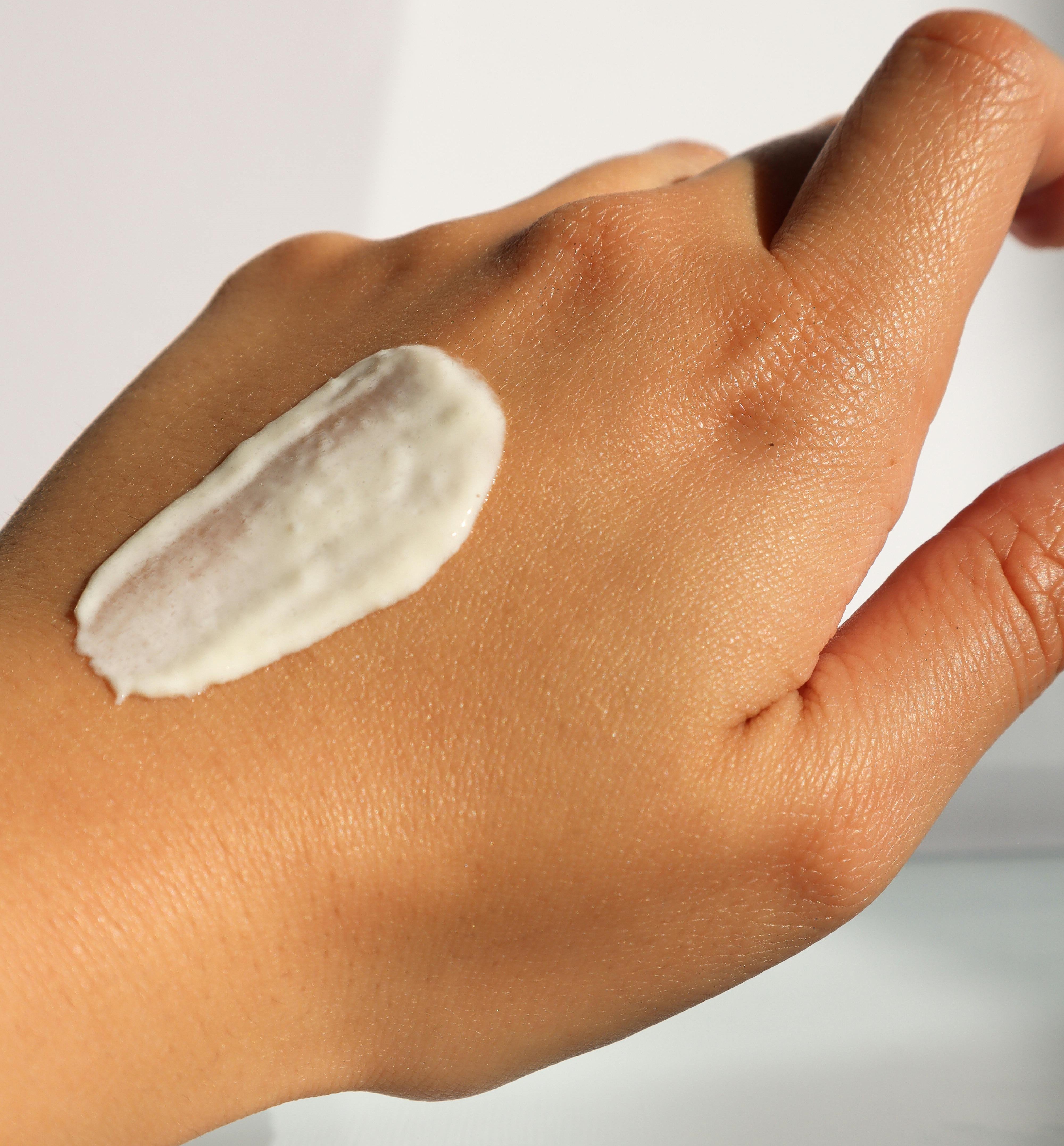 Top Treatments for Redness: The Benefits of Hydrocortisone Cream